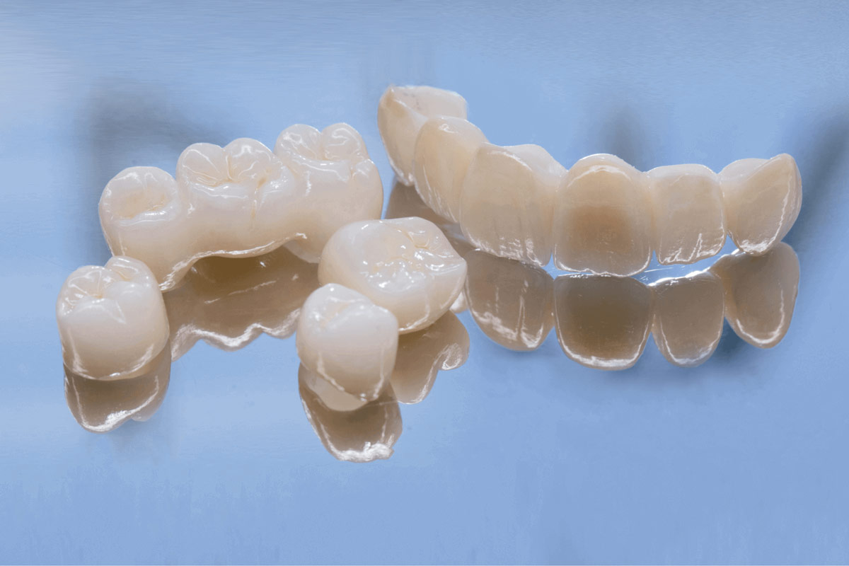 Cosmetic dentist, crowns, bridges & veneers dentist in frenchs forest northern beaches dental clinic