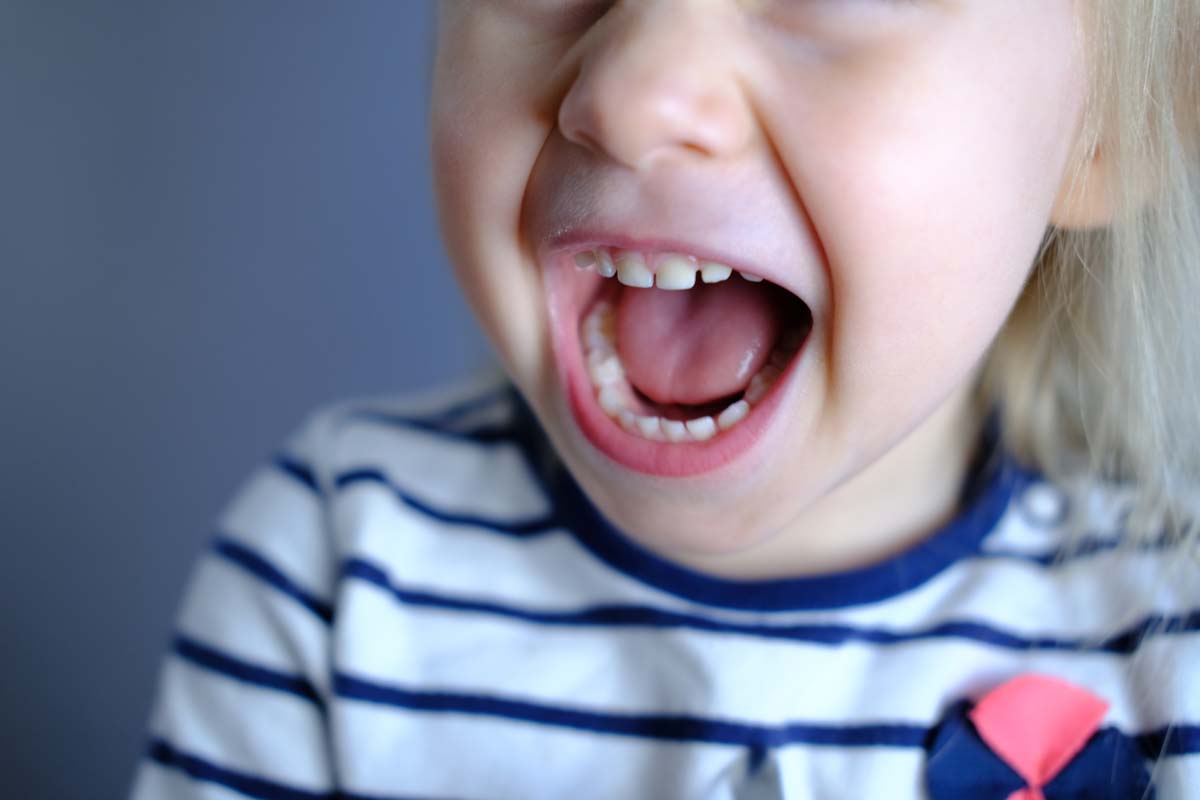 An Image of a Cheerful Child Girl Came for Dental Treatment in Frenchs Forest