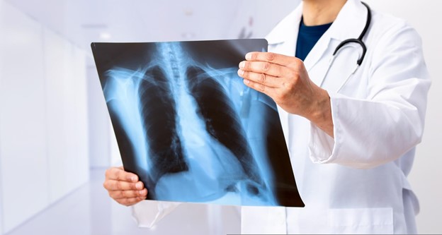 Bacteria in lungs image from a general dentistry in Frenchs Forest