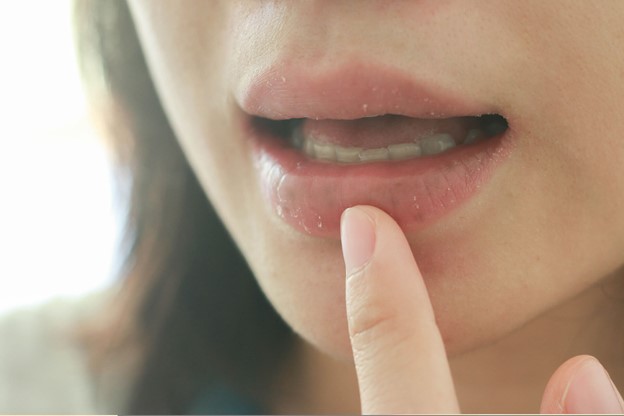 dry mouth treatment