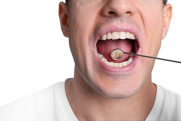 Oral Cancer Treatment in Frenchs Forest