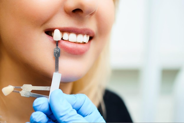 Teeth Whitening Treatment in Frenchs Forest