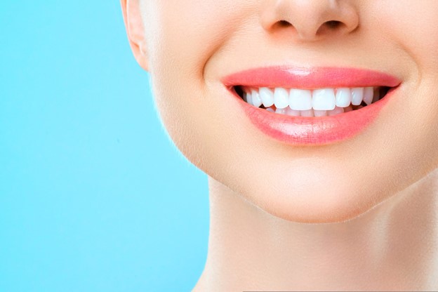 Teeth Whitening Procedure in Frenchs Forest