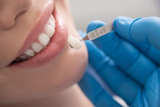 dental crown procedure in Frenchs Forest