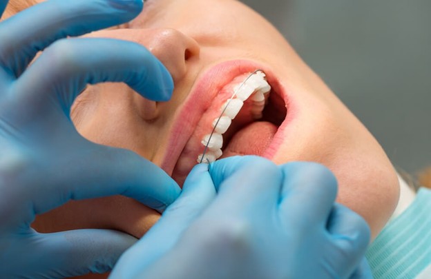 Straighten Smiles with Adult Orthodontics in french forest